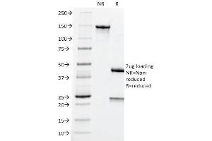 SDS-PAGE Analysis Purified CEA Mouse Monoclonal Antibody (CEA31). (CEACAM5 抗体)