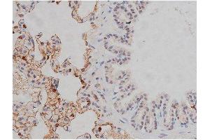 ABIN6267331 at 1/200 staining Rat lung tissue sections by IHC-P. (LYN 抗体  (pTyr507))
