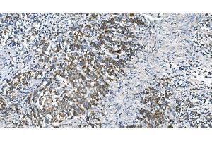 IHC analysis of DRP1/DNM1L using anti-DRP1/DNM1L antibody (ABIN7602180). (Dynamin 1-Like 抗体  (AA 618-736))