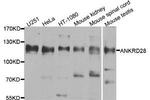 Western blot analysis of extracts of various cell lines, using ANKRD28 antibody. (ANKRD28 抗体)