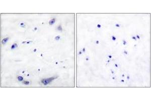 Immunohistochemistry (IHC) image for anti-Tyrosine Hydroxylase (TH) (AA 1-50) antibody (ABIN2888584) (Tyrosine Hydroxylase 抗体  (AA 1-50))