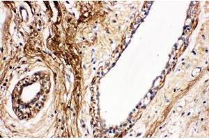 IHC analysis of Protein C using anti- Protein C antibody . (PROC 抗体  (C-Term))