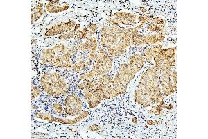 IHC analysis of BUB1B using anti-BUB1B antibody (ABIN7600962). (BUB1B 抗体  (AA 26-448))