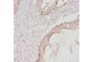 Immunohistochemistry (IHC) image for anti-14-3-3 eta (YWHAH) (AA 4-246) antibody (ABIN7142091)