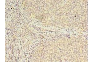 Immunohistochemistry of paraffin-embedded human tonsil tissue using ABIN7147697 at dilution of 1:100 (CBX2 抗体  (AA 1-211))