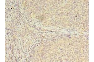 Immunohistochemistry of paraffin-embedded human tonsil tissue using ABIN7147697 at dilution of 1:100 (CBX2 抗体  (AA 1-211))