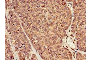 Immunohistochemistry (IHC) image for anti-Retinoic Acid Induced 1 (RAI1) (AA 617-823) antibody (ABIN7167819)