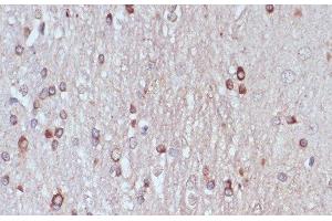 Immunohistochemistry of paraffin-embedded Rat brain using TPD52 Polyclonal Antibody at dilution of 1:100 (40x lens). (TPD52 抗体)
