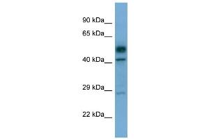 Western Blotting (WB) image for anti-serine/threonine Kinase 17a (STK17A) (C-Term) antibody (ABIN2787865) (STK17A 抗体  (C-Term))