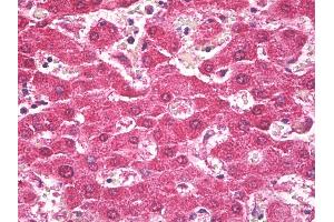 Anti-TROVE2 antibody IHC of human liver. (TROVE2 抗体)