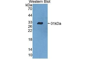 Detection of Recombinant CASP10, Human using Polyclonal Antibody to Caspase 10 (CASP10) (Caspase 10 抗体  (AA 223-459))
