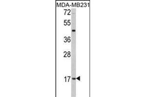 Western blot analysis of hLep- (ABIN390092 and ABIN2840608) in MDA-M cell line lysates (35 μg/lane). (Leptin 抗体  (C-Term))