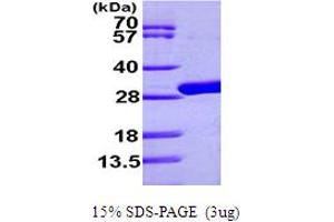 SDS-PAGE (SDS) image for UDP (AA 1-253) protein (His tag) (ABIN667172) (UDP (AA 1-253) protein (His tag))