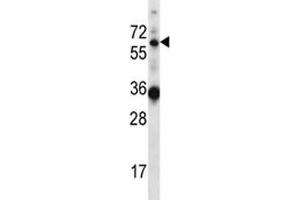 GATAD2B antibody western blot analysis in mouse heart tissue lysate (GATAD2B 抗体  (AA 1-30))