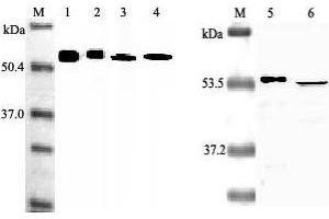 Western Blotting (WB) image for anti-Nicotinamide phosphoribosyltransferase (NAMPT) antibody (ABIN1169028)