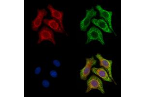 ABIN6257428 and ABIN6275868 staining H2O2 treated Hela cells by IF/ICC. (CD90 抗体  (Internal Region))