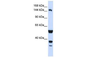 ABI3BP antibody used at 1 ug/ml to detect target protein. (ABI3BP 抗体)