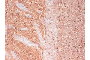 IHC analysis of Cav3. (CACNA1H 抗体  (AA 1019-1293) (PerCP))