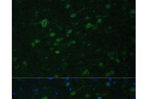 Immunofluorescence analysis of Mouse brain using KMT2E Polyclonal Antibody at dilution of 1:100. (MLL5/KMT2E 抗体)