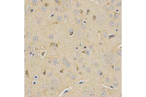 Immunohistochemistry (IHC) image for anti-Carboxypeptidase E (CPE) antibody (ABIN1876646) (CPE 抗体)