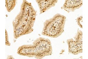 ABIN7094900 and ABIN7098953 at 1/100 staining Mouse colorectal tissue by IHC-P.