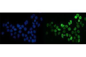 IF analysis of splicing factor 1 using anti-splicing factor 1 antibody (ABIN7600193). (Splicing Factor 1 抗体  (AA 160-266))