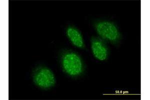 Immunofluorescence of purified MaxPab antibody to RBBP9 on HeLa cell. (RBBP9 抗体  (AA 1-186))