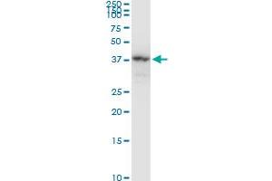 NAGK monoclonal antibody (M05), clone 1H8. (NAGK 抗体  (AA 1-344))