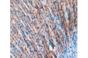 Used in DAB staining on fromalin fixed paraffin- embedded stomach tissue (PDIA2 抗体  (AA 46-258))