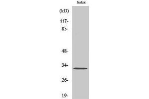 Western Blotting (WB) image for anti-Cyclin B1 Interacting Protein 1 (CCNB1IP1) (C-Term) antibody (ABIN3184993)