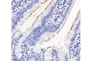 Immunohistochemistry (Paraffin-embedded Sections) (IHC (p)) image for anti-Solute Carrier Family 22 (Organic Cation Transporter), Member 1 (SLC22A1) antibody (ABIN7075663)