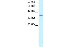RPS16 antibody (20R-1083) used at 5 ug/ml to detect target protein. (RPS16 抗体  (Middle Region))