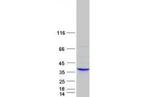Western Blotting (WB) image for Endoplasmic Reticulum-Golgi Intermediate Compartment (ERGIC) 1 (ERGIC1) protein (Myc-DYKDDDDK Tag) (ABIN2720472)