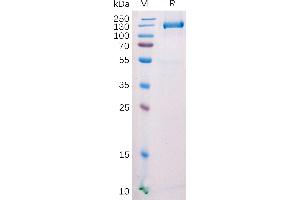 SDS-PAGE (SDS) image for Fibroblast Activation Protein, alpha (FAP) (AA 26-761) protein (mFc Tag) (ABIN6964119)