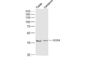 Lane 1: Mouse Testis lysates Lane 2: Mouse Cerebrum lysates probed with SOX4 Polyclonal Antibody, Unconjugated  at 1:500 dilution and 4˚C overnight incubation. (SOX4 抗体  (AA 54-103))