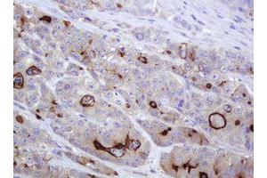 Image no. 2 for anti-ATP-Binding Cassette, Sub-Family B (MDR/TAP), Member 1 (ABCB1) (AA 347-710) antibody (ABIN1491433)