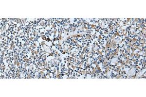 Immunohistochemistry of paraffin-embedded Human tonsil tissue using VDAC1 Polyclonal Antibody at dilution of 1:35(x200)