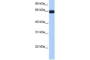 Human Lung; WB Suggested Anti-ARHGAP28 Antibody Titration: 0. (ARHGAP28 抗体  (C-Term))