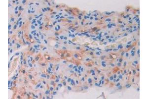 Used in DAB staining on fromalin fixed paraffin- embedded stomach tissue (Aconitase 1 抗体  (AA 527-719))