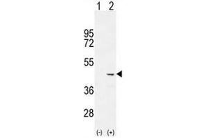 Western blot analysis of COCH (arrow) using rabbit polyclonal COCH Antibody (C-term) . (COCH 抗体  (C-Term))
