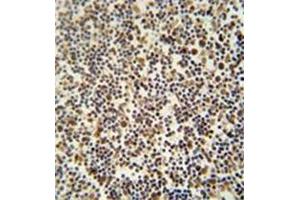 Formalin fixed, paraffin embedded human lymph tissue stained with DENND1B Antibody (N-term) followed by peroxidase conjugation of the secondary antibody and DAB staining. (DENND1B 抗体  (N-Term))