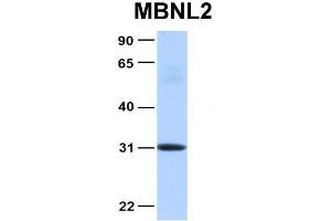 Host:  Rabbit  Target Name:  MBNL2  Sample Type:  Human Fetal Heart  Antibody Dilution:  1. (MBNL2 抗体  (Middle Region))