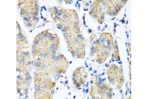 Immunohistochemistry of paraffin-embedded Human stomach using PLEK Polyclonal Antibody at dilution of 1:200 (40x lens). (Pleckstrin 抗体)