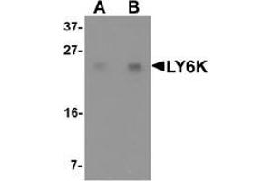 Western blot analysis of LY6K in HeLa cell lysate with LY6K Antibody  at (A) 1 and (B) 2 μg/ml. (Ly6k 抗体  (N-Term))