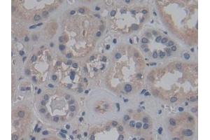 Detection of FGF12 in Human Kidney Tissue using Polyclonal Antibody to Fibroblast Growth Factor 12 (FGF12) (FGF12 抗体  (AA 1-181))