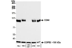 Western Blotting (WB) image for anti-CD44 (CD44) (AA 700-742) antibody (ABIN7454002) (Recombinant CD44 抗体  (AA 700-742))