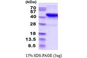 SDS-PAGE (SDS) image for Sirtuin 6 (SIRT6) (AA 1-355) protein (His tag) (ABIN666639) (SIRT6 Protein (AA 1-355) (His tag))