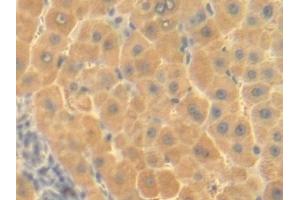 Immunohistochemistry (IHC) image for anti-Ornithine Carbamoyltransferase (OTC) (AA 78-129) antibody (ABIN7433690)