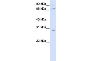 WB Suggested Anti-ZBTB48 Antibody Titration: 0. (ZBTB48 抗体  (N-Term))