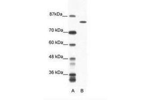 Image no. 1 for anti-DEAH (Asp-Glu-Ala-His) Box Polypeptide 16 (DHX16) (AA 352-401) antibody (ABIN6736054) (DHX16 抗体  (AA 352-401))